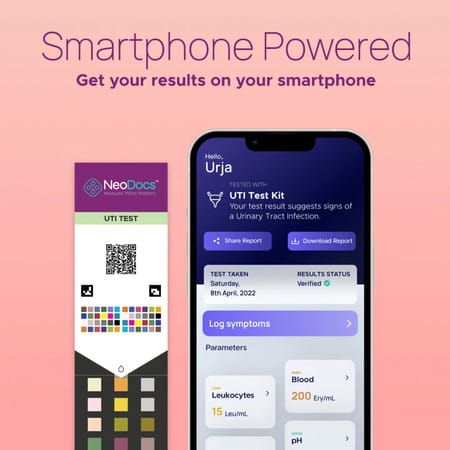 Neodocs Urinary Tract Infection Kit | Detect Uti Track Leukocytes Blood|Ph And 6 Other Parameters