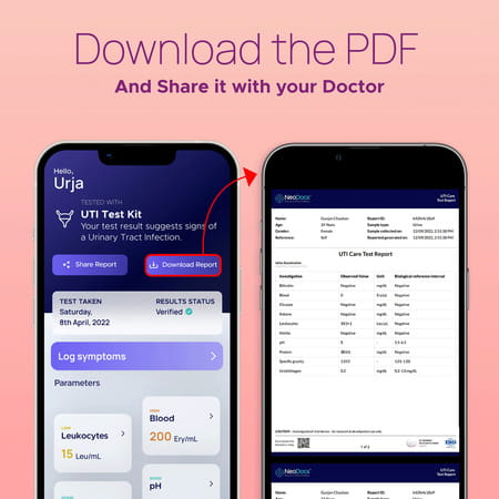 Neodocs Urinary Tract Infection Kit | Detect Uti Track Leukocytes Blood|Ph And 6 Other Parameters