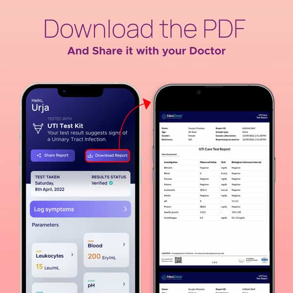 Neodocs Urinary Tract Infection Kit | Detect Uti Track Leukocytes Blood|Ph And 6 Other Parameters