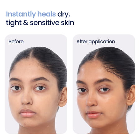 Wishcare Barrier Boost Moisturizer - Deep Nourishing Face Cream For Dry & Sensitive Skin 50 Ml