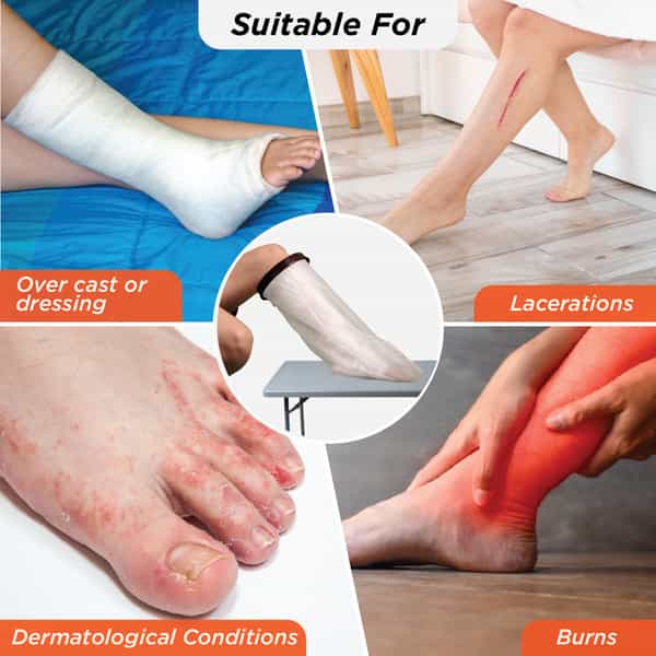 Vissco Cast Cover - Leg (Upto Knee) |Protects Bandage From Water Exposure During Bath &Shower(Grey)