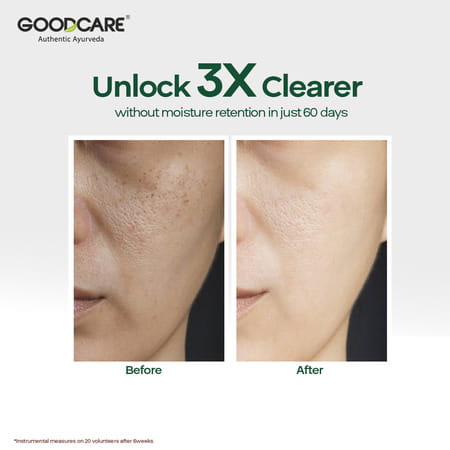 Goodcare Aloe Vera Foaming Face Wash | Soap | Sls & Paraben Free | All Skin Types - 150ml