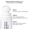 Cos-Iq Stretch Marks Removal Roll-On Serum With Striover And Retinol 40 Ml