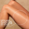 Cos-Iq Stretch Marks Removal Roll-On Serum With Striover And Retinol 40 Ml