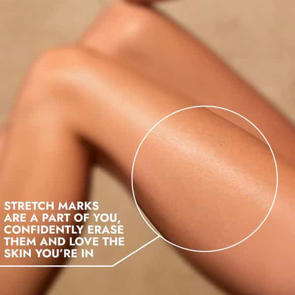 Cos-Iq Stretch Marks Removal Roll-On Serum With Striover And Retinol 40 Ml