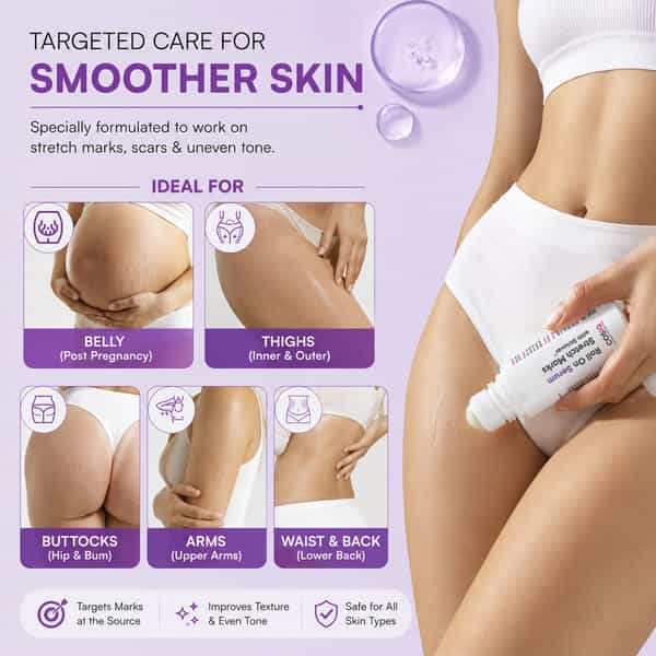 Cos-Iq Stretch Marks Removal Roll-On Serum With Striover - Scar Removal | 40Ml