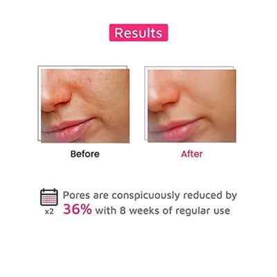 View product image 6