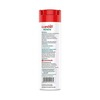 Candid Renew Calamine Anti Fungal Powder (Pack Of 2) Bottle Of 200 G