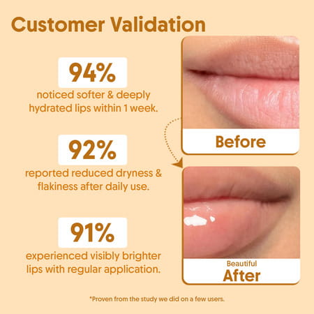 Aravi Organic Lip Glowy Balm With Spf 50 Pa+++ | 5 Gm