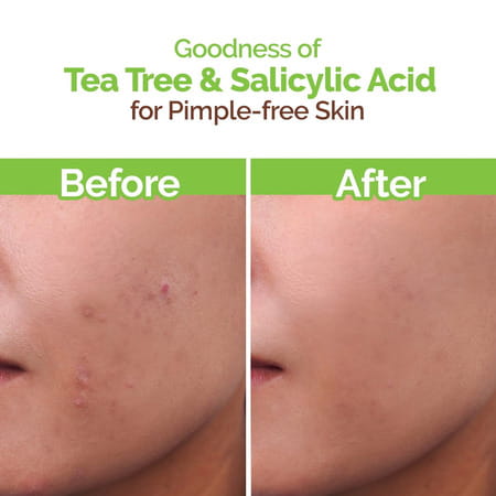 Mamaearth Tea Tree Facewash For Acne & Pimples 250ml