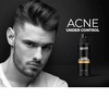 Beardo Acne Control Facewash - 100 Gm