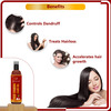 Newish Onion Hair Oil For Hair Growth (100Ml - Pack Of 2)