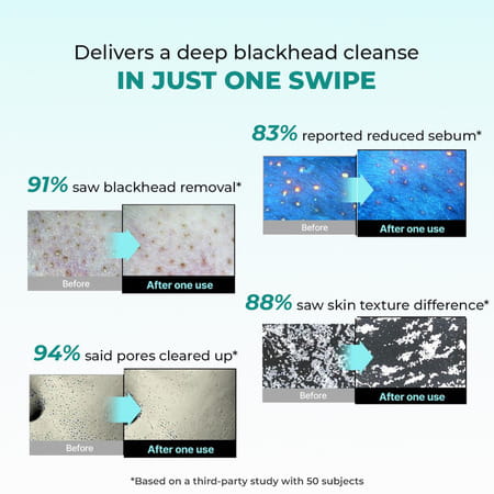 Conscious Chemist Blackhead Melting Water | 130Ml Pore Toner With Glycolic & Succinic Acid