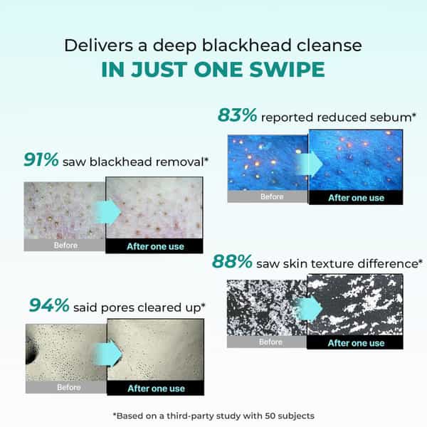 Conscious Chemist Blackhead Melting Water | 130Ml Pore Toner With Glycolic & Succinic Acid