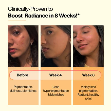 Setu Skin Renew Glutathione Tablets (30 Effervescent Tablets | Orange) With Sipper (750ml) | Combo