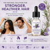 Coco Crush Rosemary Essential Oil 15Ml | 100% Pure & Undiluted For Hair Growth & Scalp Stimulation