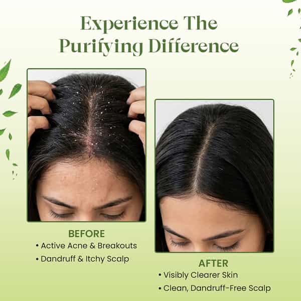 Raw Tatva Neem Powder For Acne Care| Skin Purification & Scalp Health | All Skin & Hair Types | 200G