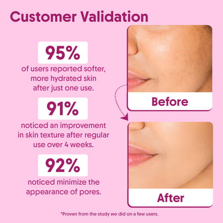 Aravi Organic Rose Water (Gulab Jal) Toner - Refreshes | Hydrates & Soothes Skin - 150ml