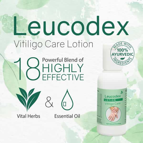 Leucodex Lotion For Skin Discoloration & White Patches Herbal Ayurvedic 50 Ml (Pack Of 2)