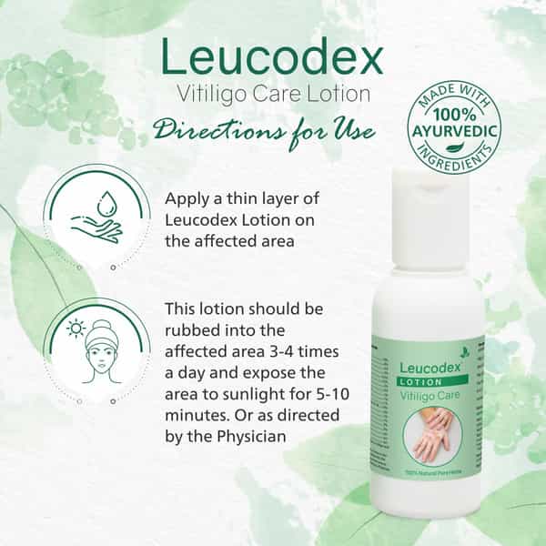 Leucodex Lotion For Skin Discoloration & White Patches Herbal Ayurvedic 50 Ml (Pack Of 2)