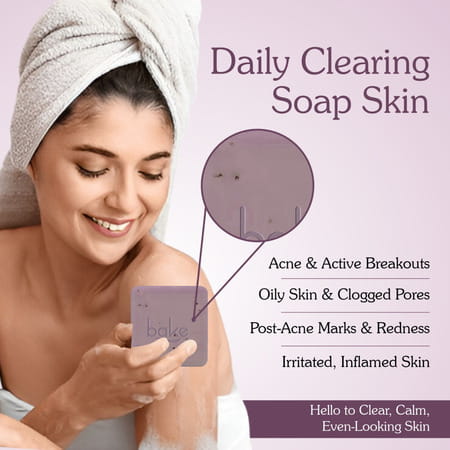 Bake 10% Niacinamide + 3% Azelaic Soap For Acne & Dark Spots (Pack Of 2)