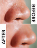 Priveda Charcoal Deep Cleansing Pore Nose Strips For Blackhead Removal (Normal 12)