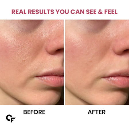 Carbamide Forte Collagen Supplements | Collagen Gummies - Mixed Fruit Flavour - 60 Gummy