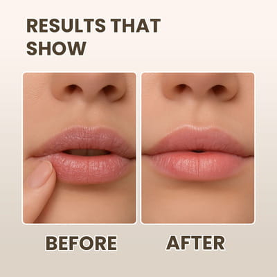 View product image 5