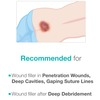 Maxiocel Wound Care Dressing For Bed Sores (2.5Cm X 30Cm) - Box Of 5 Units