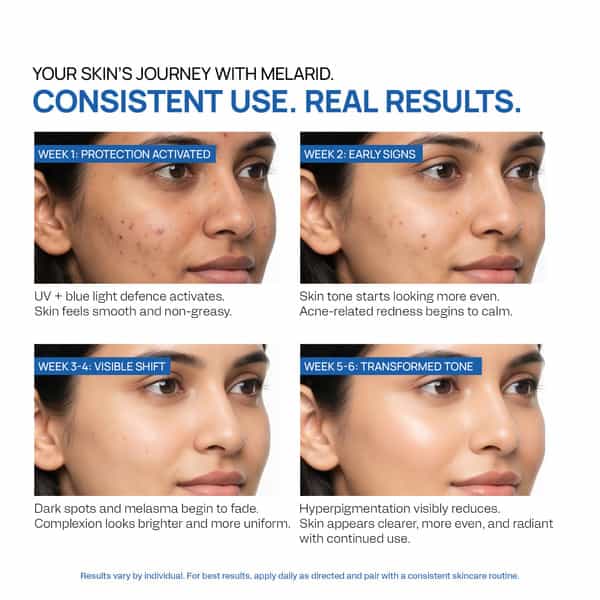 Yuderma Melarid Pigment Corrector | Spf 65 | Sunscreen 50Ml