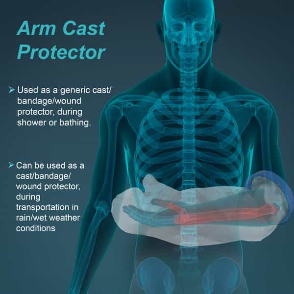 Tynor Cast Cover Arm | White | Universal Size | 1 Unit