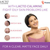Lacto Calamine Paraben Free Face Lotion For Oily Skin Bottle Of 120Ml