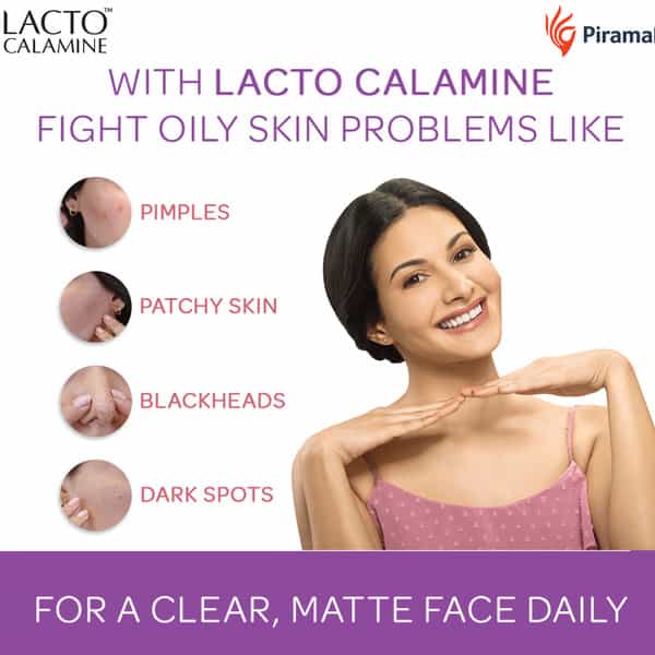 Lacto Calamine Paraben Free Face Lotion For Oily Skin Bottle Of 120Ml