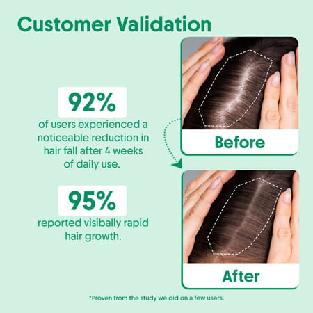 Aravi Organic Rosemary Hair Growth Serum With Biotin - Strengthens Hair - 30ml