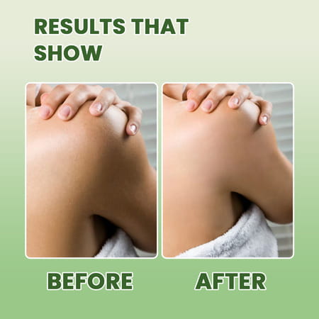 Alglaze Tea Tree Body Wash | Oil Balancing | Salicylic Acid Tea Tree Oil & Niacinamide | 200Ml