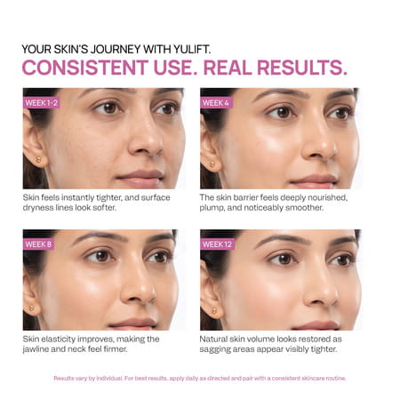 Yuderma Yulift 3X Firming With Instant Smooth & Tensor Effect Cream | 100 Ml
