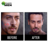 Garnier Men Acno Fight Pimple Clearing Gel 10 Ml