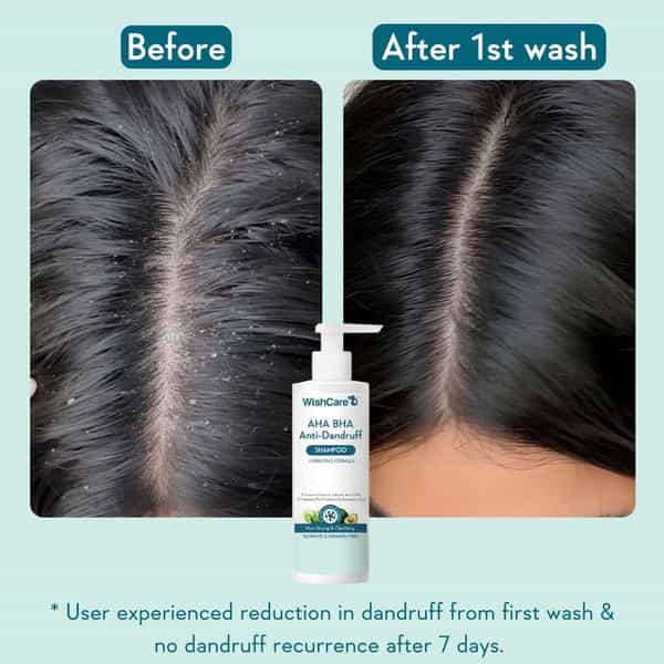 Wishcare Hydrating Aha Bha Anti Dandruff Shampoo - Sulfate & Paraben Free - 250 Ml