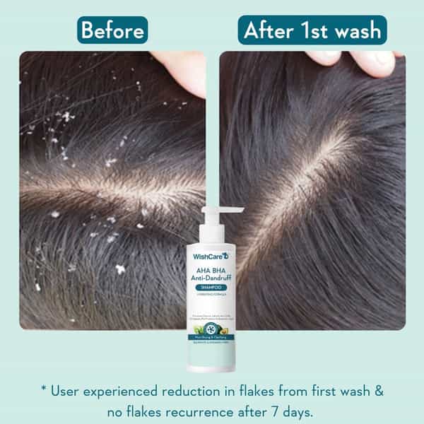 Wishcare Hydrating Aha Bha Anti Dandruff Shampoo - Sulfate & Paraben Free - 250 Ml