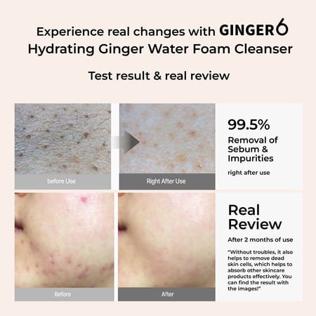 Ginger6 Hydrating Ginger Water Foam Cleanser With Salicylic Acid And Hyaluronic Acid - 150Ml