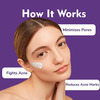 Dermistry Salicylic Acid Acne Oil Free Pimple Spots Remover Moisturizer & Face Wash For Oily Skin