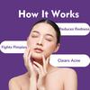 Dermistry Salicylic Acid Acne Oil Free Pimple Spots Remover Moisturizer & Face Wash For Oily Skin