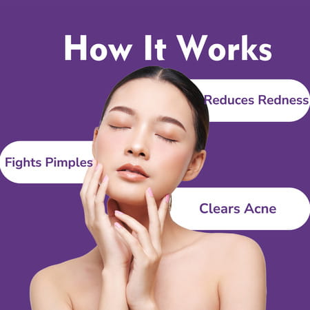 Dermistry Salicylic Acid Acne Oil Free Pimple Spots Remover Moisturizer & Face Wash For Oily Skin