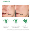 Earth Rhythm 2% Salicylic Acid - Sebum Control Serum Willow Bark Extract - 30 Ml