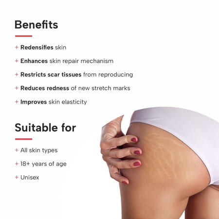 Dermatouch Bye Bye Stretch Mark Cream For Pregnancy To Reduce Stretch Marks & Scars - 125g