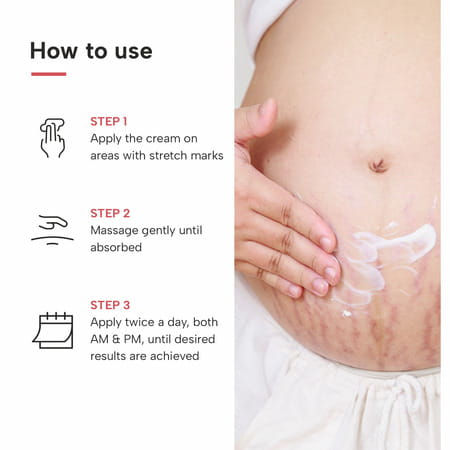 Dermatouch Bye Bye Stretch Mark Cream For Pregnancy To Reduce Stretch Marks & Scars - 125g