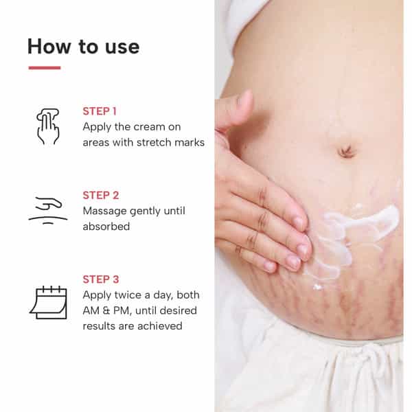 Dermatouch Bye Bye Stretch Mark Cream For Pregnancy To Reduce Stretch Marks & Scars - 125G