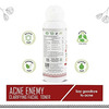Ayouthveda Skin Detox Acne Control Kit