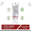 Ayouthveda Skin Detox Acne Control Kit