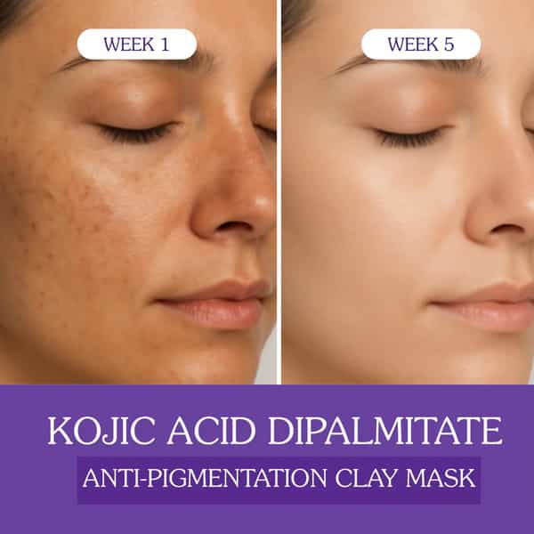 Bake 2% Kojic Acid Dipalmitate Clay Mask For Pigmentation - 100G